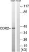 Caudal Type Homeobox 2 antibody, TA326196, Origene, Western Blot image 