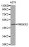 Prokineticin Receptor 2 antibody, abx002155, Abbexa, Western Blot image 