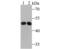 4-Aminobutyrate Aminotransferase antibody, NBP2-80446, Novus Biologicals, Western Blot image 