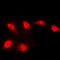 Histone Deacetylase 5 antibody, LS-C353222, Lifespan Biosciences, Immunofluorescence image 