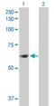 Zinc Finger Protein 599 antibody, H00148103-B01P, Novus Biologicals, Western Blot image 