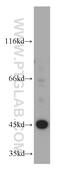 Etoposide-induced protein 2.4 antibody, 20456-1-AP, Proteintech Group, Western Blot image 