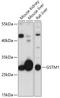 Glutathione S-Transferase Mu 1 antibody, 16-958, ProSci, Western Blot image 