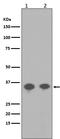 Protein Phosphatase 2 Catalytic Subunit Alpha antibody, P01893, Boster Biological Technology, Western Blot image 