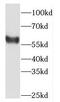 Dachshund Family Transcription Factor 2 antibody, FNab02231, FineTest, Western Blot image 