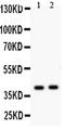 NDRG Family Member 2 antibody, PA5-79721, Invitrogen Antibodies, Western Blot image 