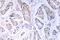 Eukaryotic Translation Initiation Factor 4E Binding Protein 1 antibody, AP21009PU-N, Origene, Immunohistochemistry frozen image 