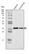 DNA-binding protein inhibitor ID-1 antibody, A00945-2, Boster Biological Technology, Western Blot image 