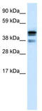 C-Terminal Binding Protein 1 antibody, TA330555, Origene, Western Blot image 