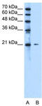 Uncharacterized protein C20orf24 antibody, TA331052, Origene, Western Blot image 