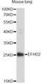 EF-Hand Domain Family Member D2 antibody, A14926, ABclonal Technology, Western Blot image 