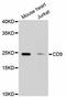 CD9 Molecule antibody, A10789, ABclonal Technology, Western Blot image 