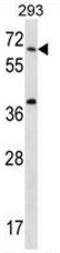 Syntaxin-binding protein 2 antibody, AP54095PU-N, Origene, Western Blot image 