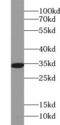Sirtuin 5 antibody, FNab07883, FineTest, Western Blot image 