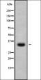 5-Hydroxytryptamine Receptor 3C antibody, orb336381, Biorbyt, Western Blot image 