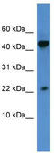 Regenerating Family Member 3 Alpha antibody, TA339881, Origene, Western Blot image 