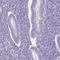 SH3 Domain Containing GRB2 Like 3, Endophilin A3 antibody, HPA039381, Atlas Antibodies, Immunohistochemistry paraffin image 