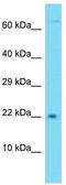 Transmembrane Protein 52B antibody, TA333472, Origene, Western Blot image 