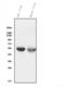 Cytochrome P450 Family 2 Subfamily C Member 19 antibody, M02102-1, Boster Biological Technology, Western Blot image 