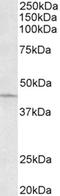 Neuropilin 2 antibody, orb67247, Biorbyt, Western Blot image 