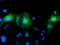 LRAT Domain Containing 2 antibody, MA5-25310, Invitrogen Antibodies, Immunocytochemistry image 