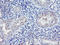Hes-1 antibody, LS-C173600, Lifespan Biosciences, Immunohistochemistry paraffin image 