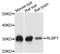 Retinaldehyde Binding Protein 1 antibody, A9094, ABclonal Technology, Western Blot image 
