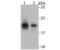Suppressor of cytokine signaling 2 antibody, NBP2-75671, Novus Biologicals, Western Blot image 