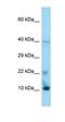 LOC645504 antibody, orb325641, Biorbyt, Western Blot image 