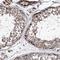 Zinc Finger Protein 487 antibody, NBP1-93560, Novus Biologicals, Immunohistochemistry paraffin image 