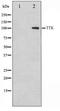 TTK Protein Kinase antibody, TA347333, Origene, Western Blot image 
