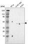 Interleukin 13 Receptor Subunit Alpha 1 antibody, HPA000293, Atlas Antibodies, Western Blot image 