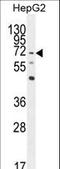 Negative Regulator Of Reactive Oxygen Species antibody, LS-C165877, Lifespan Biosciences, Western Blot image 
