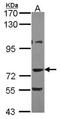 A-Kinase Anchoring Protein 10 antibody, NBP1-31483, Novus Biologicals, Western Blot image 