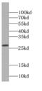 Deoxyguanosine kinase, mitochondrial antibody, FNab02354, FineTest, Western Blot image 