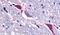 NK-3R antibody, PA5-34249, Invitrogen Antibodies, Immunohistochemistry paraffin image 