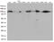 EWS RNA Binding Protein 1 antibody, M00589-1, Boster Biological Technology, Western Blot image 