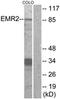 Adhesion G Protein-Coupled Receptor E2 antibody, LS-C120581, Lifespan Biosciences, Western Blot image 