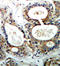 PTPN11 antibody, STJ22358, St John