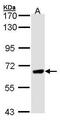 Protein Phosphatase With EF-Hand Domain 1 antibody, GTX102537, GeneTex, Western Blot image 