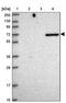 Netrin 3 antibody, PA5-62249, Invitrogen Antibodies, Western Blot image 