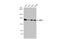 ATP Binding Cassette Subfamily C Member 1 antibody, GTX116046, GeneTex, Western Blot image 