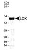 Lysyl Oxidase antibody, NB100-2530, Novus Biologicals, Western Blot image 