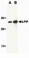 STE20 Related Adaptor Beta antibody, orb74516, Biorbyt, Western Blot image 