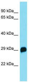 R3H domain-containing protein 4 antibody, TA333437, Origene, Western Blot image 