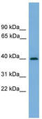 Serpin Family B Member 8 antibody, TA344594, Origene, Western Blot image 