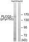Phospholipase C Gamma 2 antibody, LS-C199477, Lifespan Biosciences, Western Blot image 
