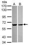 Pyridine Nucleotide-Disulphide Oxidoreductase Domain 2 antibody, GTX120980, GeneTex, Western Blot image 