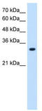 Large neutral amino acids transporter small subunit 2 antibody, TA333385, Origene, Western Blot image 