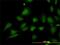Stromal Interaction Molecule 1 antibody, MCA3475Z, Bio-Rad (formerly AbD Serotec) , Western Blot image 